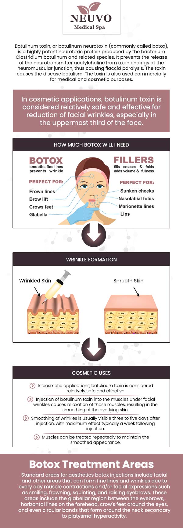 Botox is a popular cosmetic treatment that helps smooth out fine lines and wrinkles by temporarily relaxing the muscles that cause them. It's commonly used on areas like the forehead, crow's feet, and frown lines. At Neuvo Medical Spa, our team is dedicated to providing personalized Botox treatments to help you achieve a youthful, refreshed appearance with minimal downtime. For more information, contact us or request an appointment online. We are conveniently located at 2653 Bruce B Downs Blvd, Unit 119, Wesley Chapel, FL 33543.
