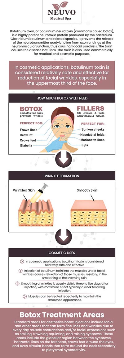 Botox is a popular cosmetic treatment that helps smooth out fine lines and wrinkles by temporarily relaxing the muscles that cause them. It's commonly used on areas like the forehead, crow's feet, and frown lines. At Neuvo Medical Spa, our team is dedicated to providing personalized Botox treatments to help you achieve a youthful, refreshed appearance with minimal downtime. For more information, contact us or request an appointment online. We are conveniently located at 2653 Bruce B Downs Blvd, Unit 119, Wesley Chapel, FL 33543.
