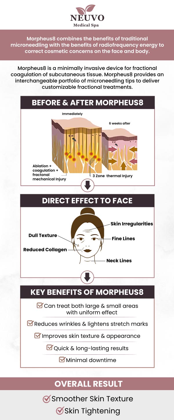 At Neuvo Medical Spa, our team offers Morpheus8 treatment to help tighten skin, reduce wrinkles, and improve overall skin tone. This non-invasive treatment combines microneedling and radiofrequency energy for enhanced skin rejuvenation. For more information or to schedule your appointment, contact us or book online. We are conveniently located at 2653 Bruce B Downs Blvd, Unit 119, Wesley Chapel, FL 33543. At Neuvo Medical Spa, our team offers Morpheus8 treatment to help tighten skin, reduce wrinkles, and improve overall skin tone. This non-invasive treatment combines microneedling and radiofrequency energy for enhanced skin rejuvenation. For more information or to schedule your appointment, contact us or book online. We are conveniently located at 2653 Bruce B Downs Blvd, Unit 119, Wesley Chapel, FL 33543.