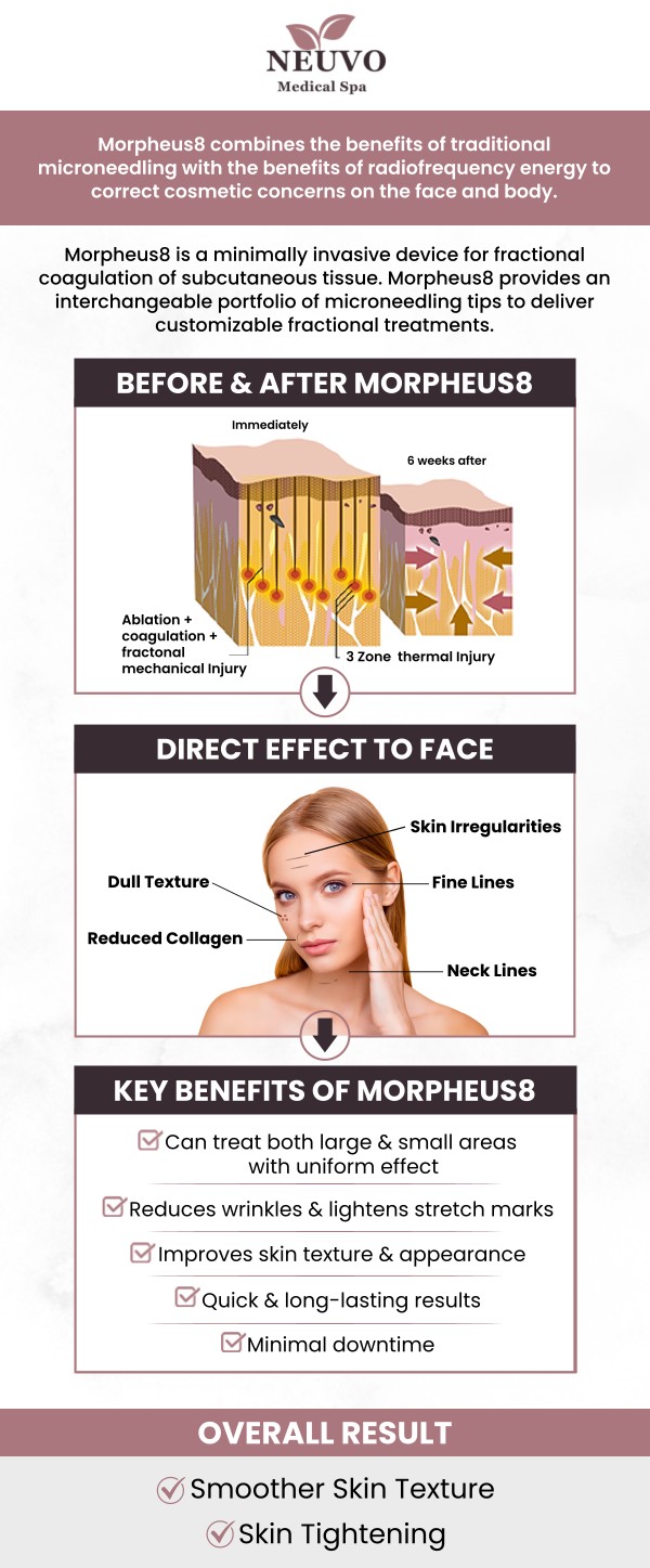 At Neuvo Medical Spa, our team of experts is dedicated to helping you choose the best skin treatment for your needs. While both Morpheus8 and traditional microneedling are effective for rejuvenating the skin, Morpheus8 combines microneedling with radiofrequency for deeper penetration and enhanced results. For more information, contact us or request an appointment online. We are conveniently located at 2653 Bruce B Downs Blvd, Unit 119, Wesley Chapel, FL 33543. At Neuvo Medical Spa, our team of experts is dedicated to helping you choose the best skin treatment for your needs. While both Morpheus8 and traditional microneedling are effective for rejuvenating the skin, Morpheus8 combines microneedling with radiofrequency for deeper penetration and enhanced results. For more information, contact us or request an appointment online. We are conveniently located at 2653 Bruce B Downs Blvd, Unit 119, Wesley Chapel, FL 33543.
